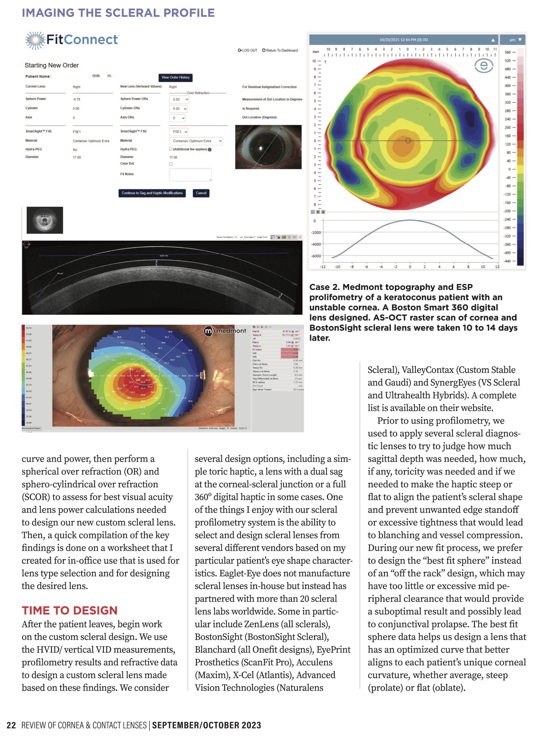 Imaging the Scleral Profile for Enhanced Scleral Lens Results By Joseph DiGiorgio, OD. Page 3