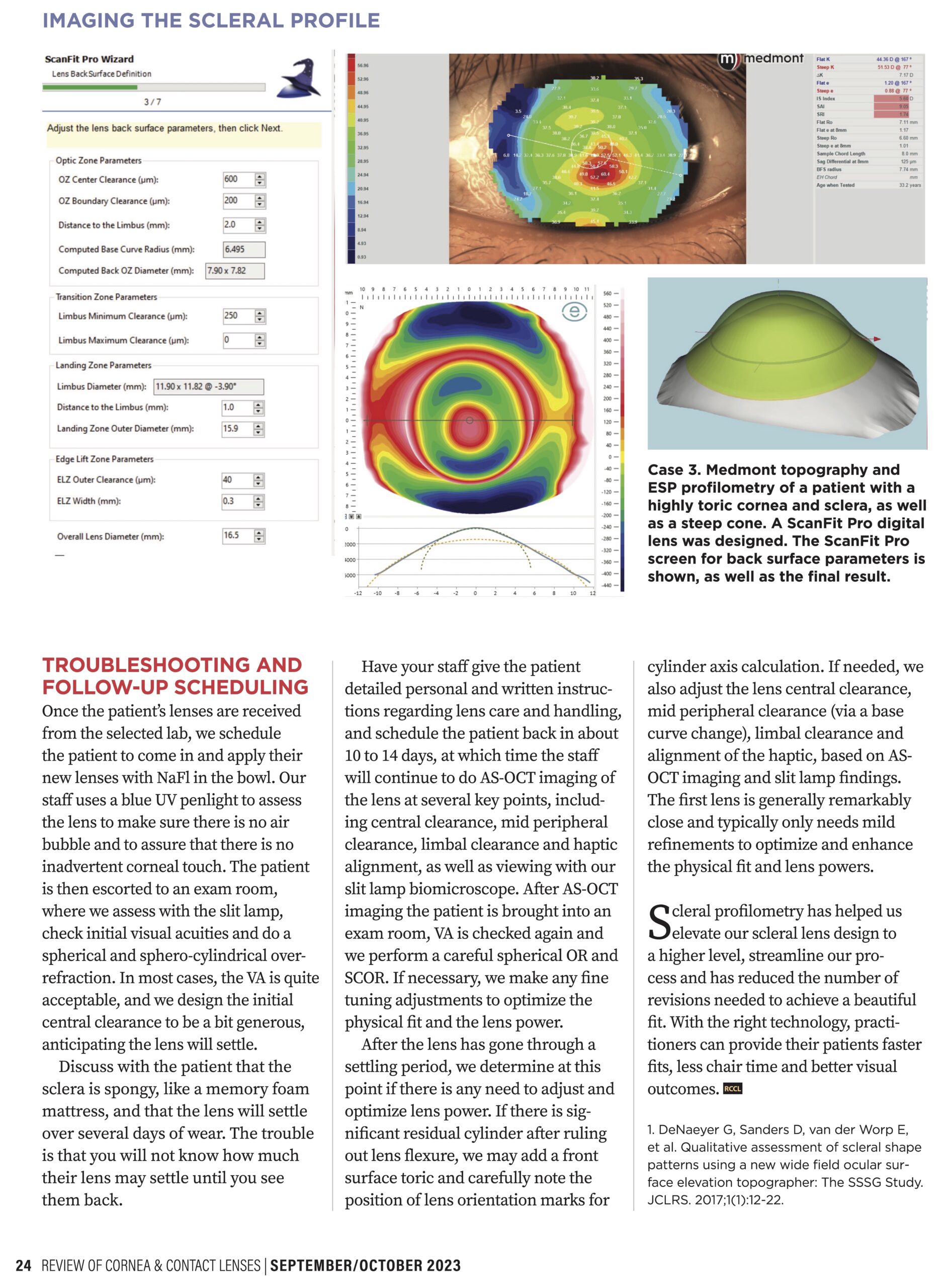 Imaging the Scleral Profile for Enhanced Scleral Lens Results By Joseph DiGiorgio, OD, Page 4