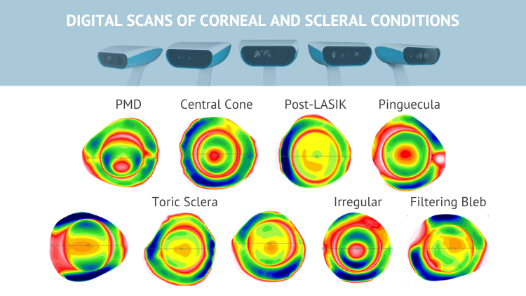 Eaglet ESP, Eye Surface Profile,Digital Scleral Lens